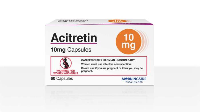 Acitretin