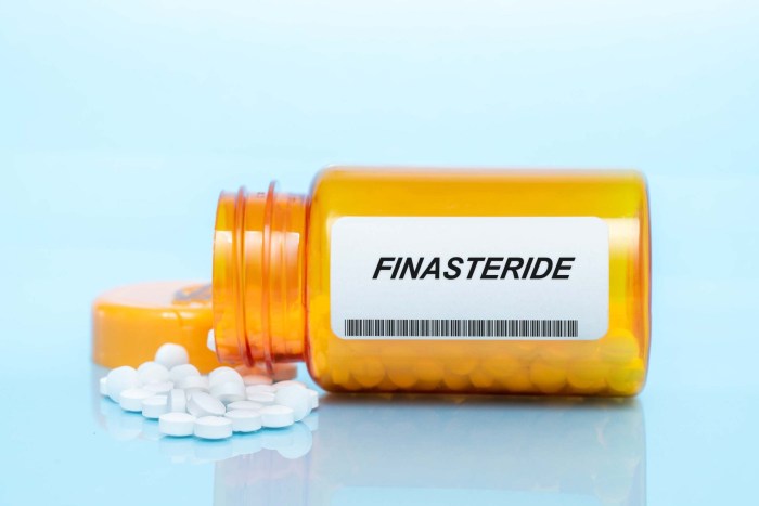 Finasterida finasteride 5mg alopecia proscar propecia