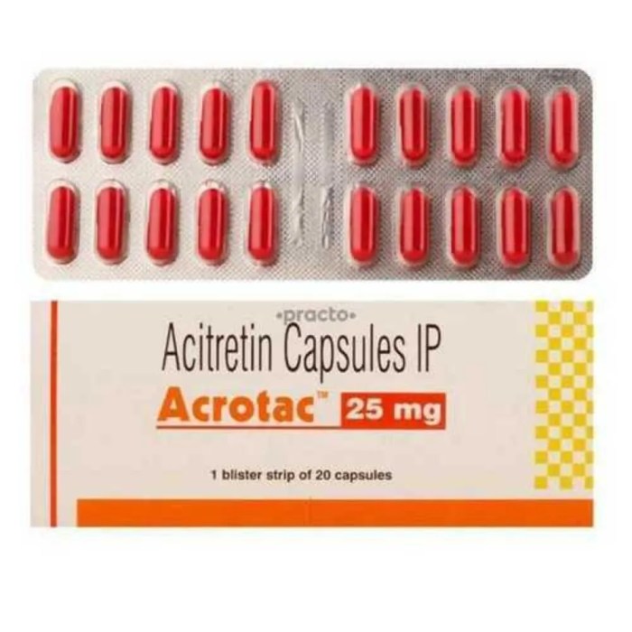 Acitretin