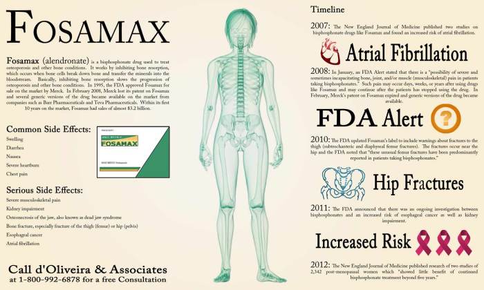 Fosamax side effects